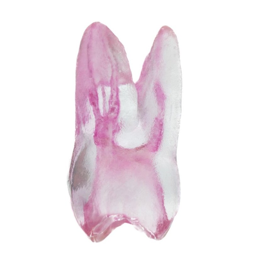 Endotooth 16 Upper Molar (Biovoxel Typodont) - Priehladnosť: Nepriehladný, Trepanácia: Intaktný, netrepanovaný, Zubná dreň: S dreňou