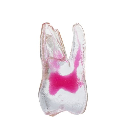 EndoTooth 16 Upper Molar (More Complex) - Transparency: Opaque, Tooth Access: Accessed, Pulp: With pulpal tissue