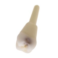 CariesTooth 16 (KaVo Analog)