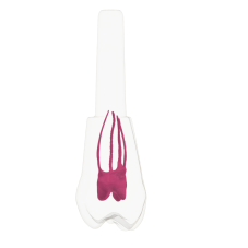 EndoTooth 16 Upper Molar - Less Complex (KaVo Analog)