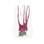 Opaque Endotooth 16 with Occlusal Caries (Biovoxel Typodont)