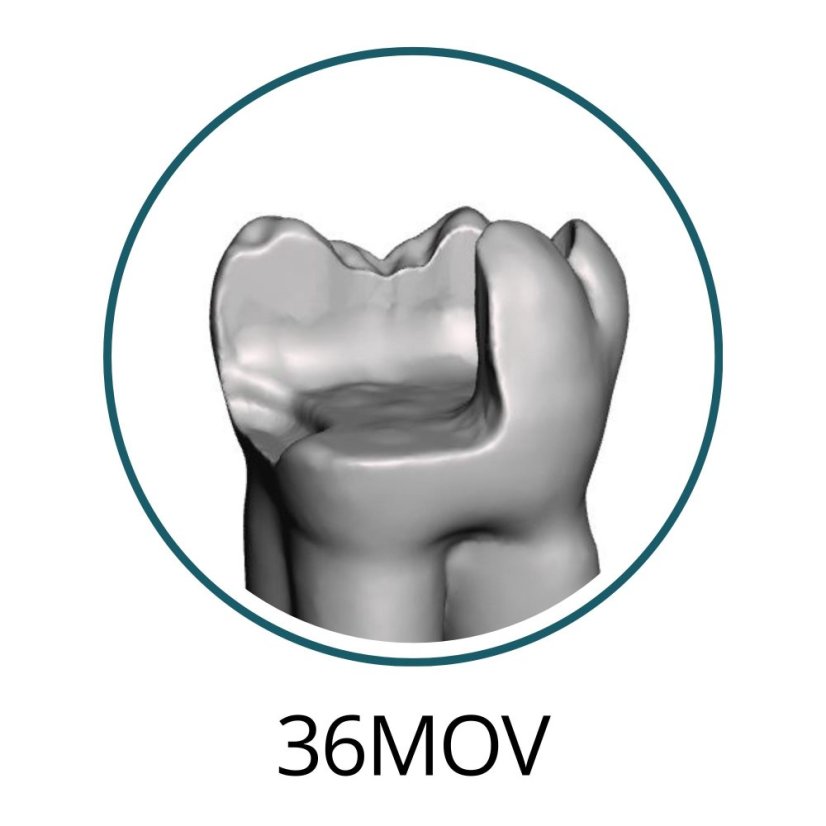 Monomaterial Teeth with Cavities (Biovoxel Typodont) - Zahn wählen: 37 Occlusal Cavity