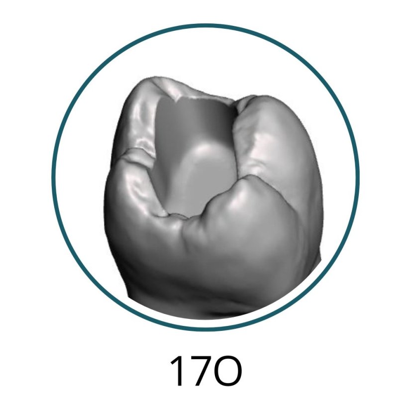 Monomaterial Teeth with Cavities (Biovoxel Typodont) - Zahn wählen: 37 Occlusal Cavity