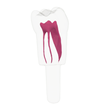 EndoTooth 36 Lower Molar (KaVo Analog)