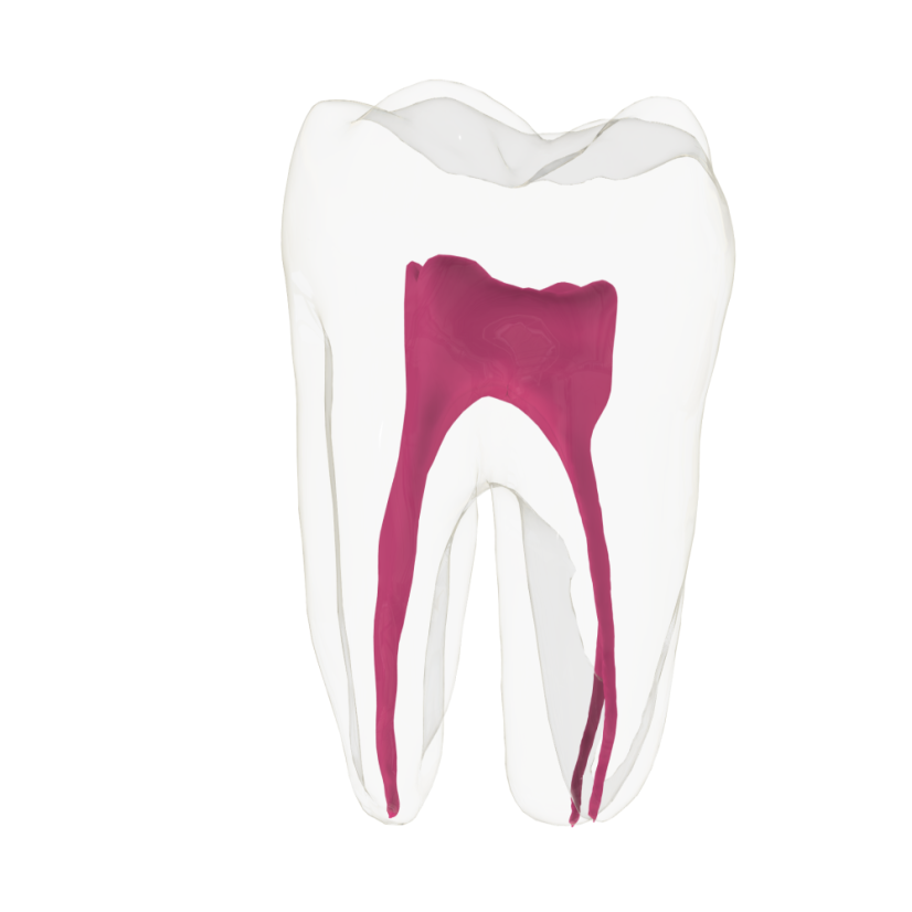 EndoTooth 36 Lower Molar (Less Complex) - Transparencia: Transparente, Acceso al diente: Intacto, no accedido