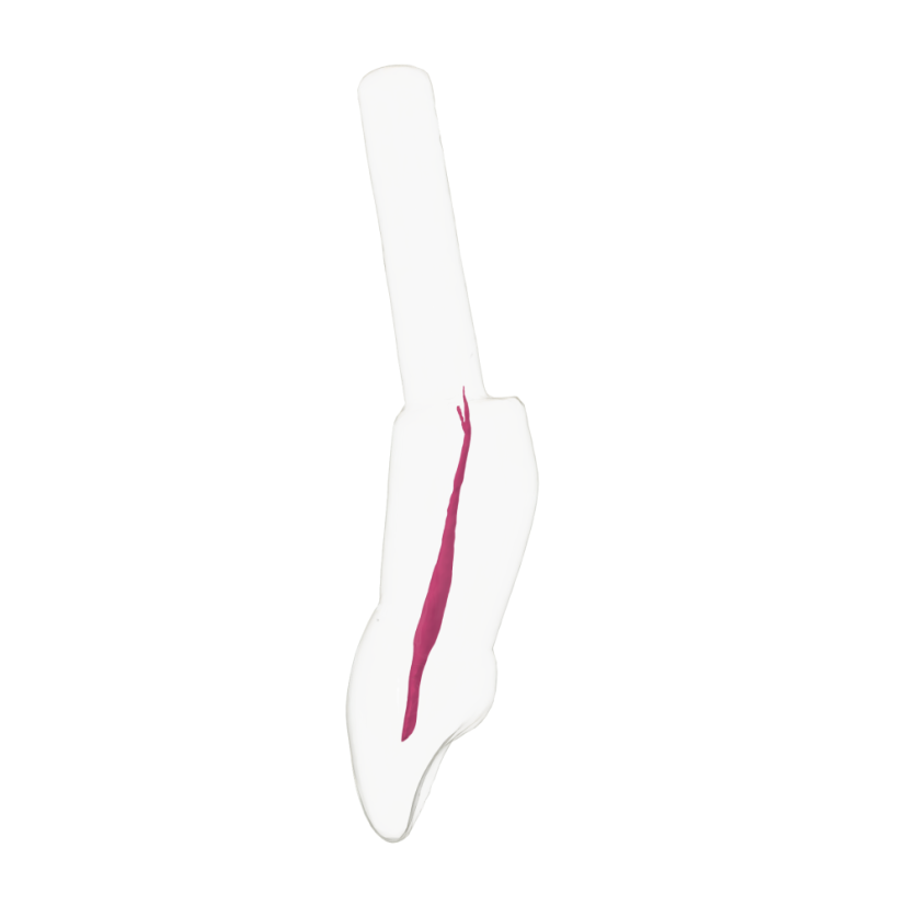EndoTooth 11 Central Incisor (KaVo Analog)