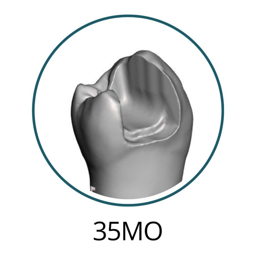 Monomaterial Teeth with Cavities (Biovoxel Typodont) - Elige el diente: 15 Mesio - Occluso - Distal Cavity
