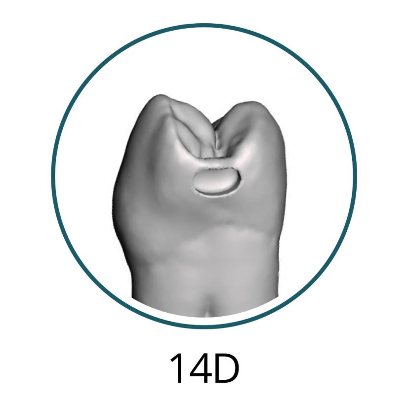 Monomaterial Teeth with Cavities (Biovoxel Typodont) - Elige el diente: 15 Mesio - Occluso - Distal Cavity