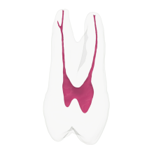EndoTooth 24 Upper Premolar