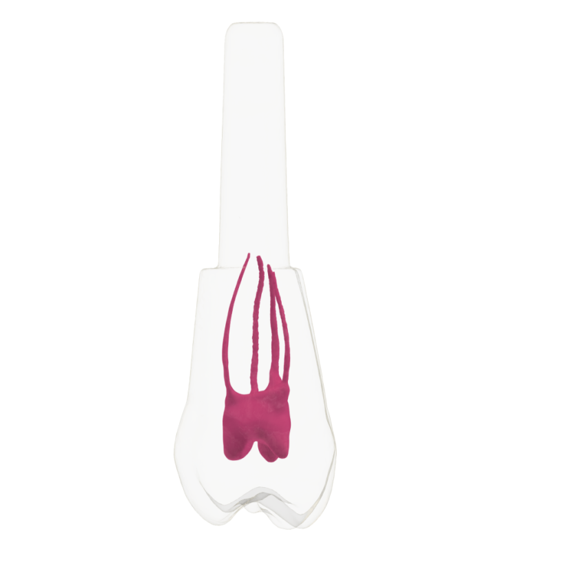 EndoTooth 16 Upper Molar - Less Complex (KaVo Analog)
