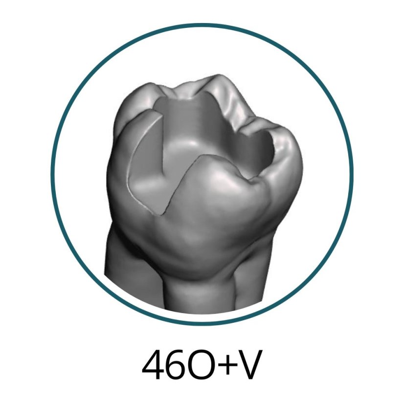 Monomaterial Teeth with Cavities (Biovoxel Typodont) - Elige el diente: 15 Mesio - Occluso - Distal Cavity