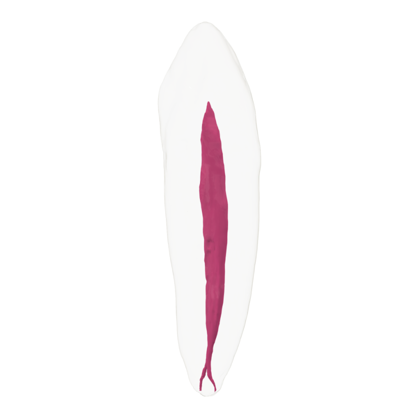EndoTooth 43 Lower Canine - Transparency: Opaque, Tooth Access: Accessed, Pulp: Without the pulp