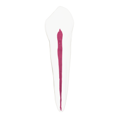 EndoTooth 43 Lower Canine