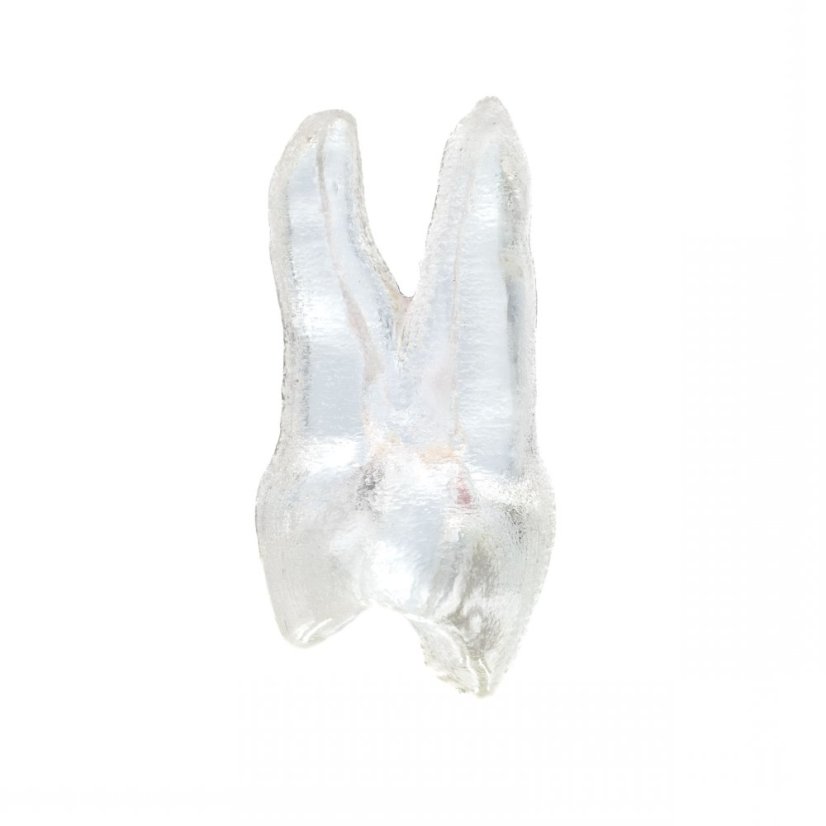 EndoTooth 14 Upper Premolar (Mesio-Occlusal access) - Transparencia: Transparente, Pulpa dental: Sin pulpa