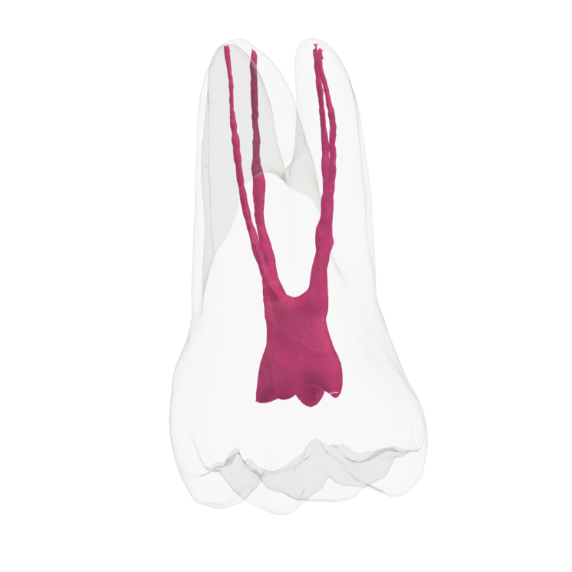 Endotooth 16 Upper Molar (Biovoxel Typodont)