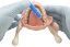 Mandibular Anesthesia Model