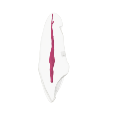 EndoTooth 11 Upper Incisor - (Biovoxel Typodont)
