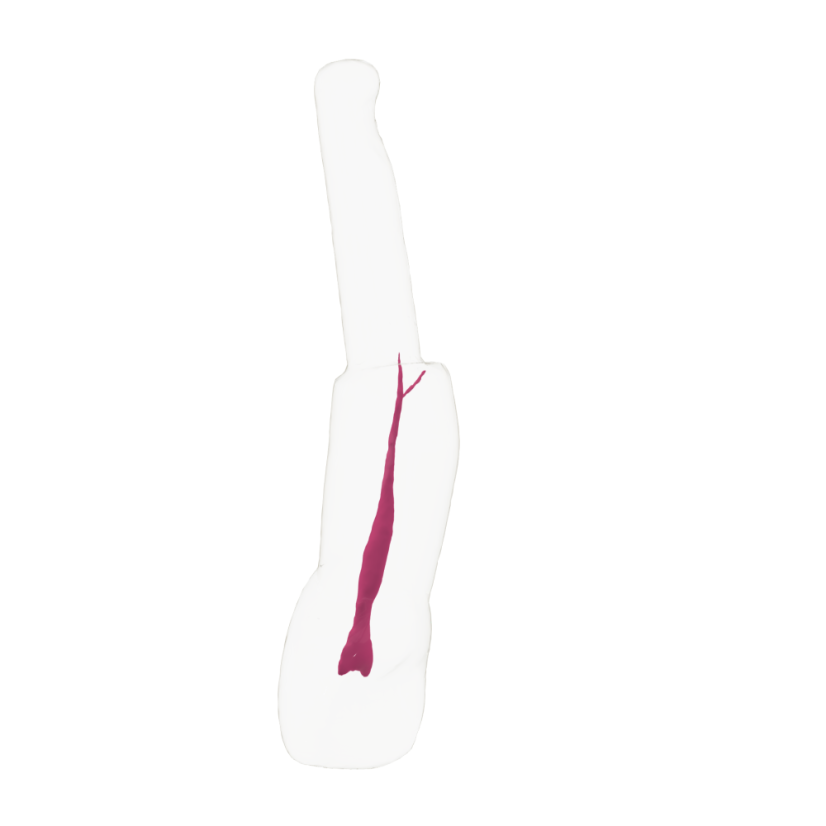 EndoTooth 11 Central Incisor (KaVo Analog)