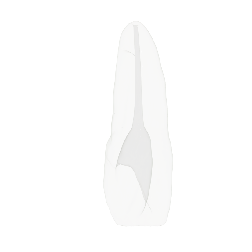EndoTooth 11 Upper Incisor for Internal Bleach Training (Biovoxel Typodont)