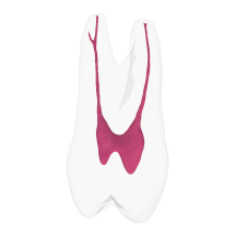 EndoTooth 24 Upper Premolar
