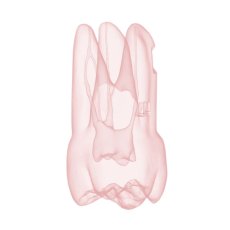 Endotooth 17 Upper Molar (Biovoxel Typodont)