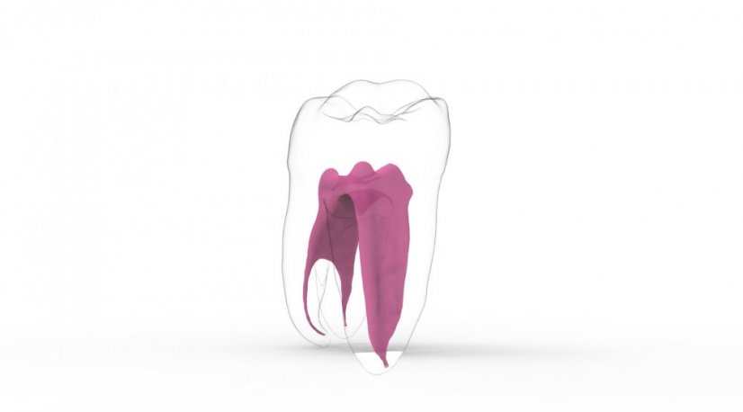 EndoTooth 37 Lower Molar (More Complex) - Acceso al diente: Intacto, no accedido, Pulpa dentaria: Con tejido pulpar