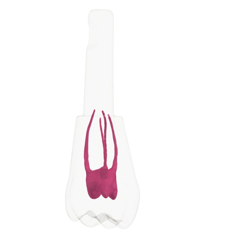 EndoTooth 16 Upper Molar - Less Complex (KaVo Analog)