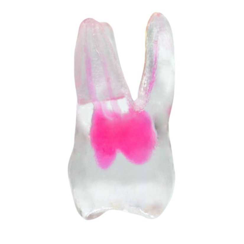 EndoTooth 16 Upper Molar (Less Complex) - Transparencia: Transparente, Acceso al diente: Intacto, no accedido, Pulpa dental: Con pulpa