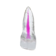 EndoTooth 11 Upper Incisor