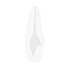 EndoTooth 11 Upper Incisor for Internal Bleach Training (Biovoxel Typodont)