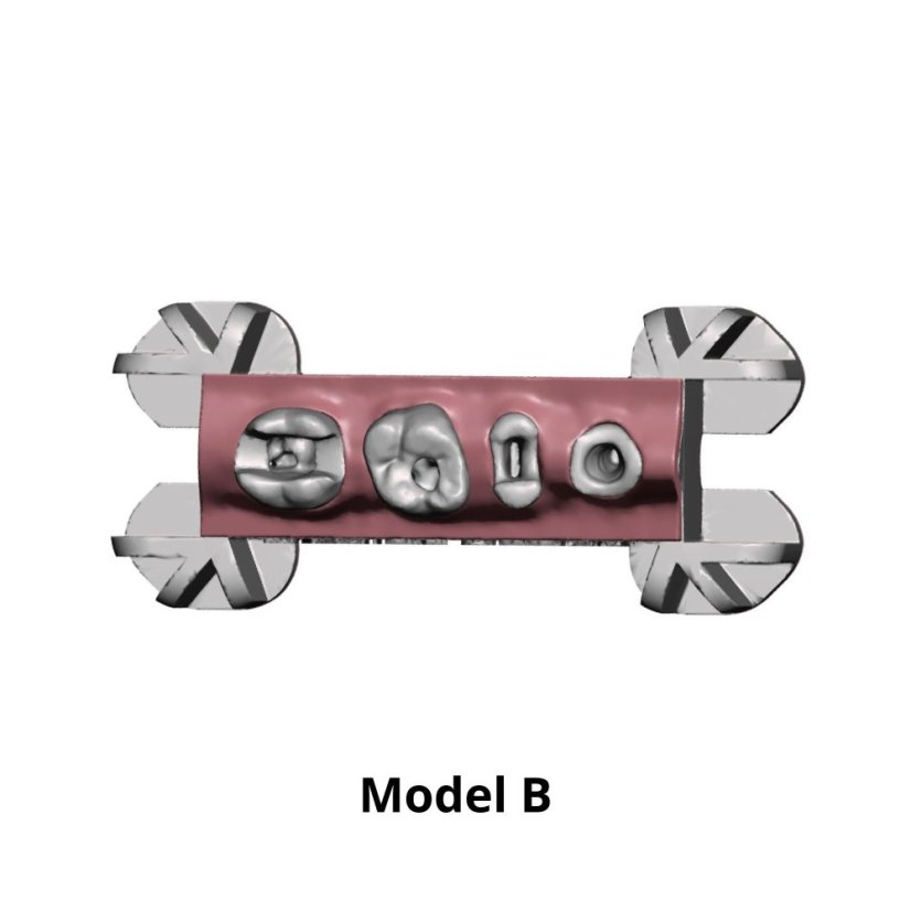 Post-Endo Model - Modelo: Modelo B