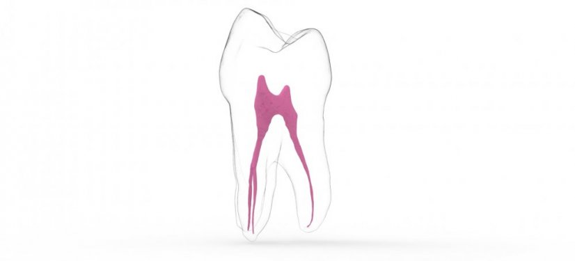 EndoTooth 14 Upper Premolar - Priehladnosť: Priehľadný, Trepanácia: Trepanovaný, Zubná dreň: Bez drene