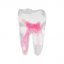 EndoTooth 36 Lower Molar (Less Complex) - Trepanácia: Intaktný, netrepanovaný, Zubná dreň: S dreňou