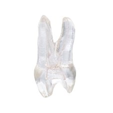EndoTooth 14 Upper Premolar (Mesio-Occlusal access)
