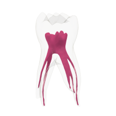 EndoTooth 84 Deciduous Lower Molar