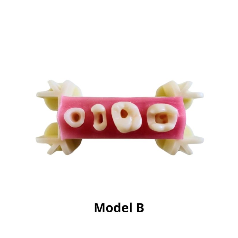 Post-Endo Model