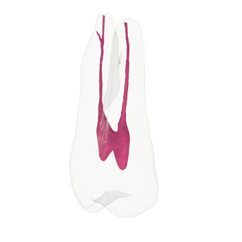 EndoTooth 24 Upper Premolar