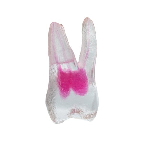 EndoTooth 16 Upper Molar (Less Complex) - Transparency: Transparent, Tooth Access: Accessed, Pulp: With pulpal tissue