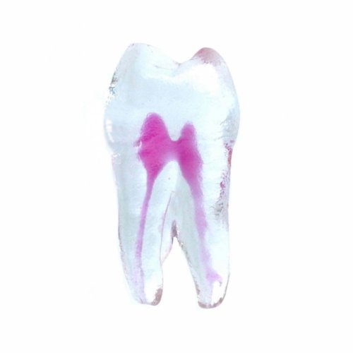 EndoTooth 24 Upper Premolar - Trepanácia: Intaktný, netrepanovaný, Zubná dreň: S dreňou