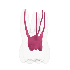 EndoTooth 16 Upper Molar (Less Complex)