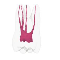 Endotooth 16 Upper Molar (Biovoxel Typodont)