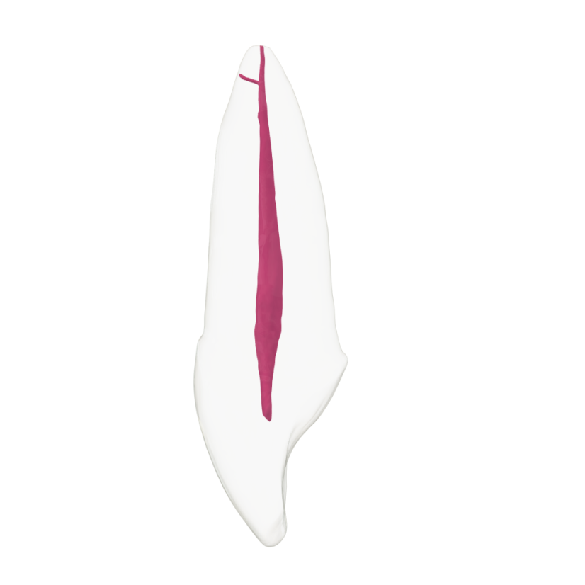 EndoTooth 11 Upper Incisor - Transparencia: Transparente, Acceso al diente: Accedido, Pulpa dental: Con pulpa