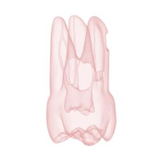 Endotooth 17 Upper Molar (Biovoxel Typodont)