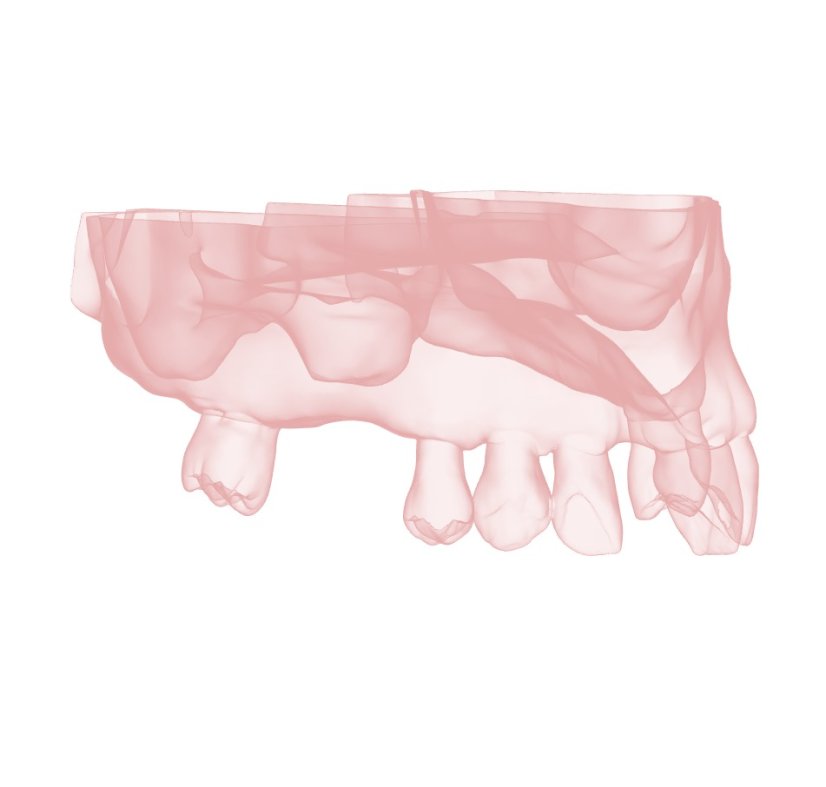 Surgical Training Jaw Model