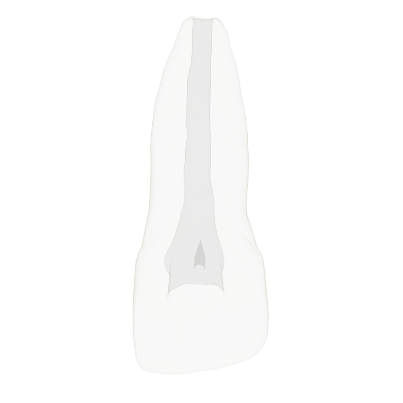EndoTooth 11 Upper Incisor for Internal Bleach Training (Biovoxel Typodont)