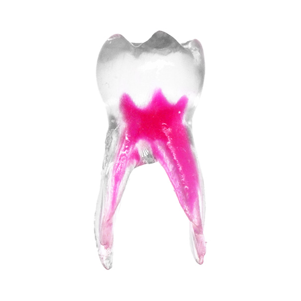 EndoTooth 84 Deciduous Lower Molar - Transparencia: Opaco, Acceso al diente: Intacto, no accedido, Pulpa dentaria: Con tejido pulpar