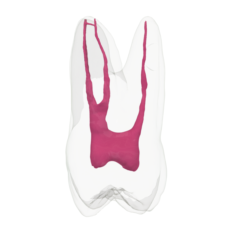Endotooth 16 Upper Molar (Biovoxel Typodont)