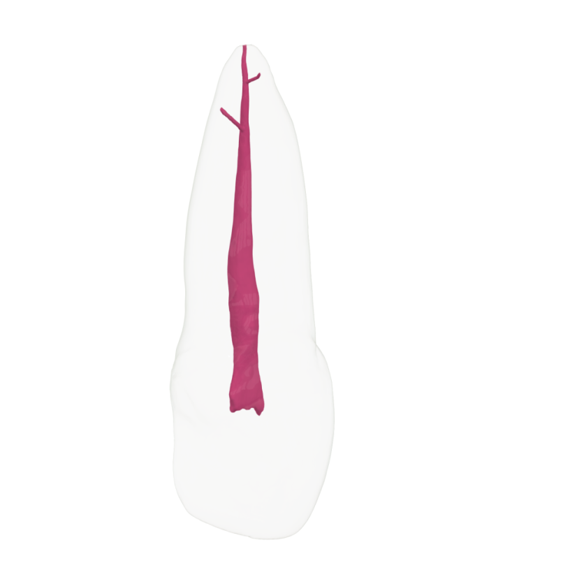 EndoTooth 11 Upper Incisor - Transparencia: Transparente, Acceso al diente: Accedido, Pulpa dental: Con pulpa