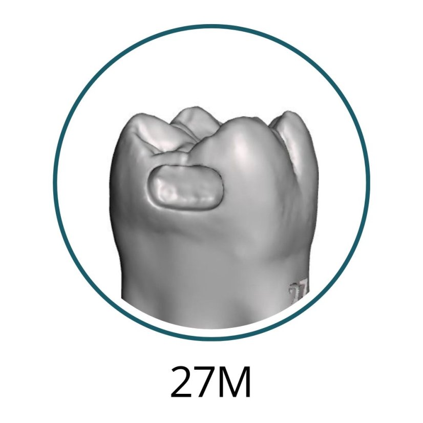 Monomaterial Teeth with Cavities (Biovoxel Typodont) - Zahn wählen: 37 Occlusal Cavity