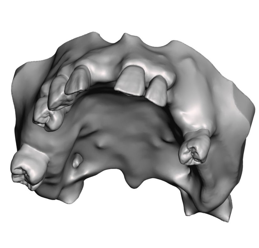 Surgical Training Jaw Model